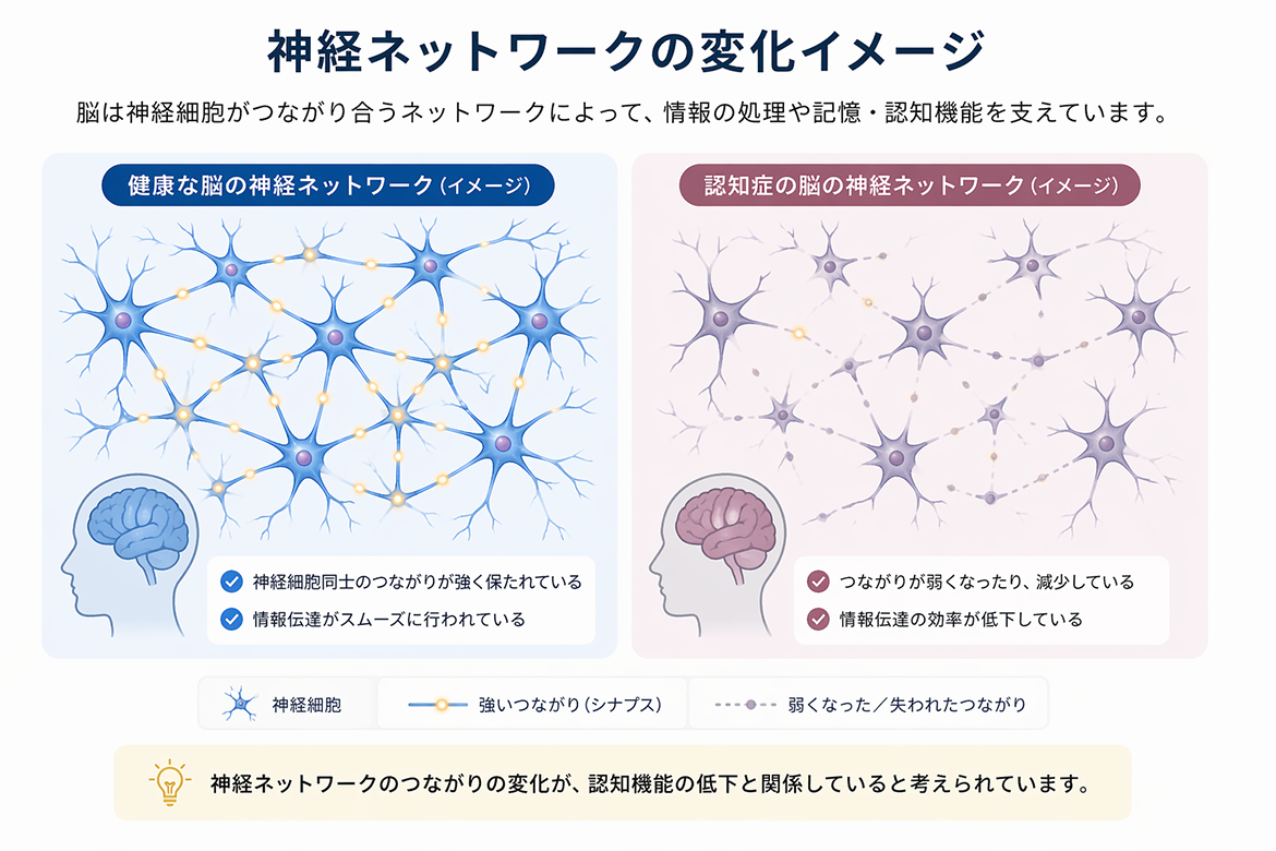 神経ネットワークの変化イメージ画像